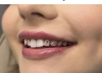 Tooth gems by Ever and Ivory - Teeth Whitening and Tooth Gems, Pimpama, Queensland, AU. Close-up of a sparkling smile.