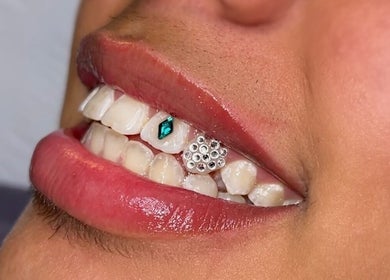 Close-up of tooth gems from Ever and Ivory - Teeth Whitening and Tooth Gems in Pimpama, Queensland, AU.