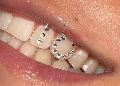 Tooth gems sparkle on a bright smile at Ever and Ivory - Teeth Whitening and Tooth Gems, Pimpama, Queensland, AU.