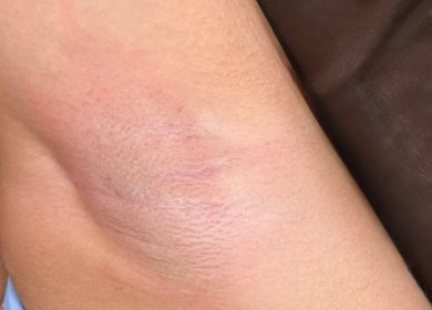 Close-up of smooth skin after waxing at Bare Bottoms Wax Studio, Ottawa, Ontario, CA.