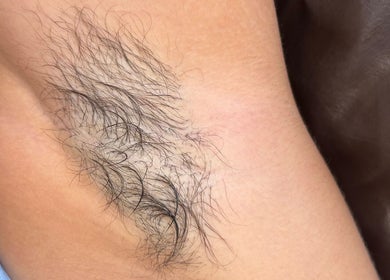 Close-up of natural underarm hair at Bare Bottoms Wax Studio in Ottawa, Ontario, CA.