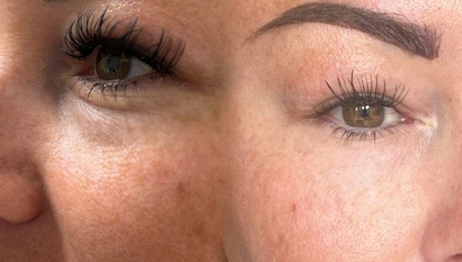Saving Face Aesthetics & Beauty image 1