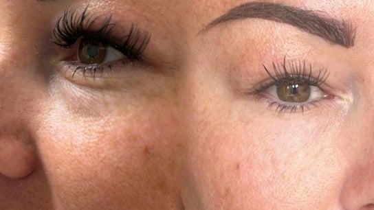 Saving Face Aesthetics & Beauty