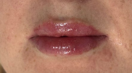 Saving Face Aesthetics & Beauty image 2