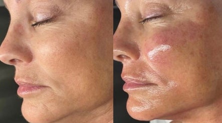 Saving Face Aesthetics & Beauty image 3