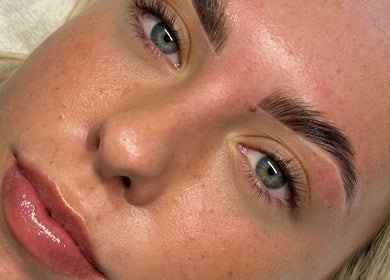Close-up of glowing skin after treatment at Aura Aesthetics, Thornlands, Queensland, AU.