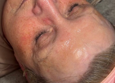 Skincare treatment at Kays Beauty & Aesthetics in Stoke-on-Trent, England, GB showcasing a glowing complexion.
