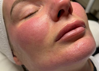 Facial treatment at Essence - Nails | Beauty | Skin, Warrington Town Centre, England, GB highlights radiant skin.