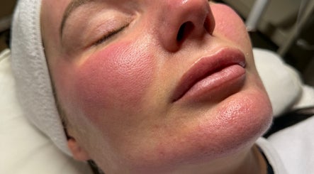 Facial treatment at Essence - Nails | Beauty | Skin, Warrington Town Centre, England, GB highlights radiant skin.