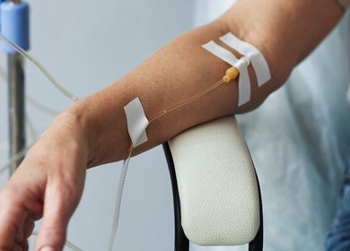 IV hydration therapy at Skin and Drip in London, England, GB, showing arm with IV line.