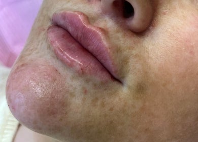 Close-up of lip treatment at Luscious Lashes, Gosport, England, GB, highlighting smooth, hydrated lips.