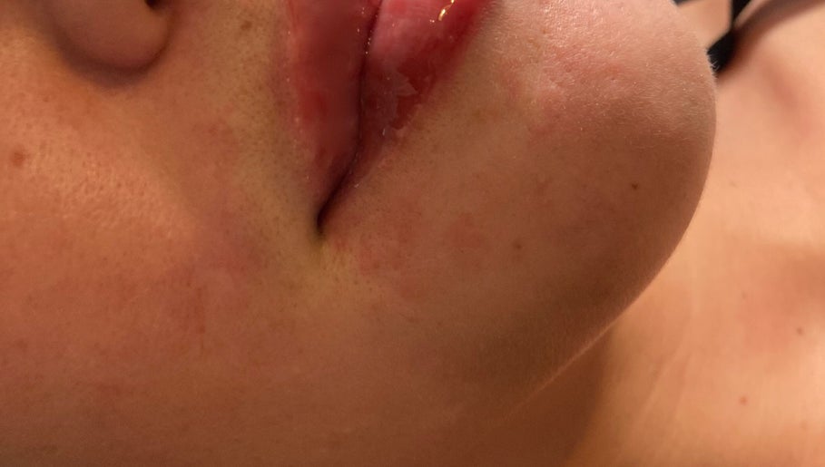 Close-up of well-nourished lips at Aesthetics By Ashley, Cheshire, England, GB.