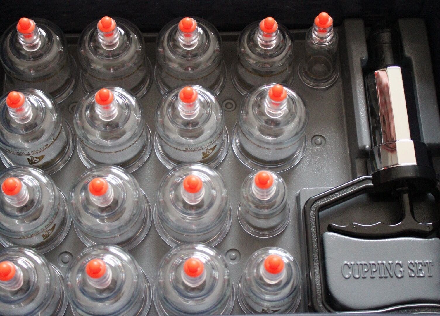 Cupping therapy set at Hughes Massage Therapy, Sleaford, England, GB for wellness treatments.