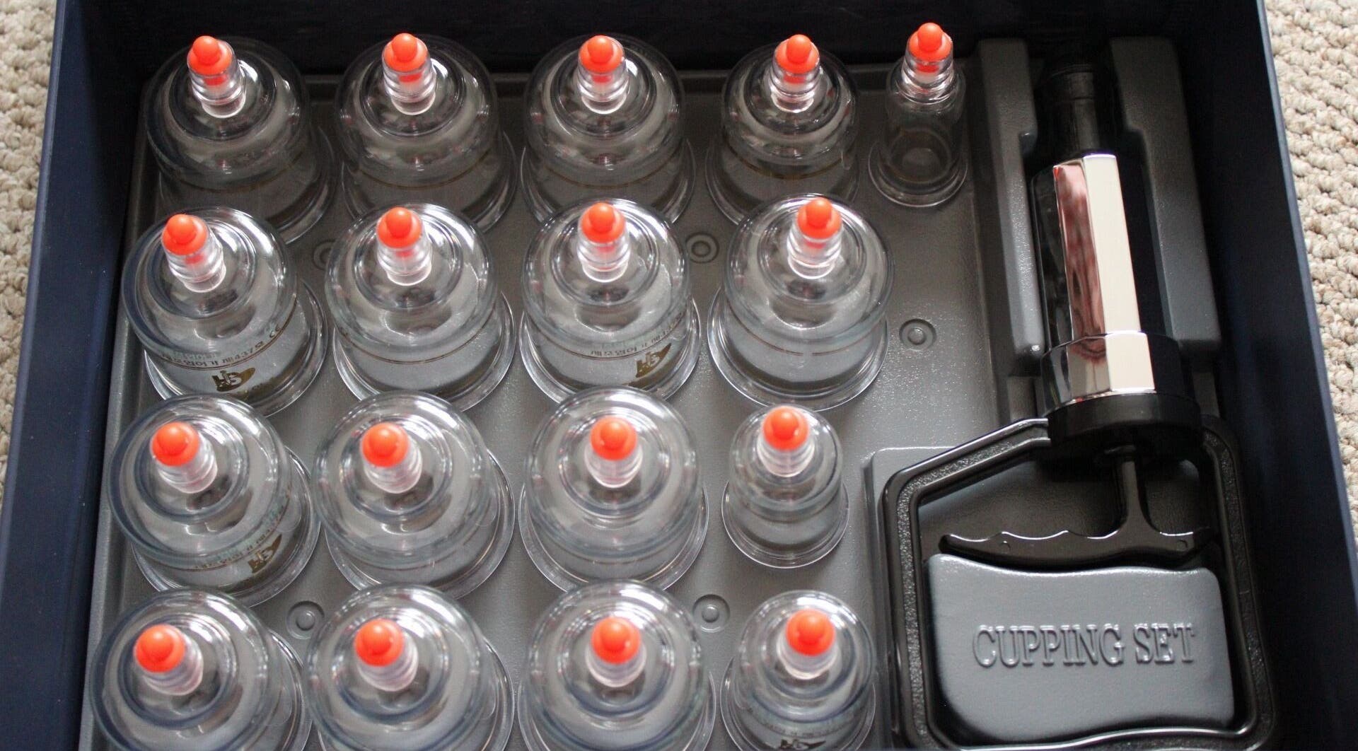 Cupping therapy set at Hughes Massage Therapy, Sleaford, England, GB for wellness treatments.