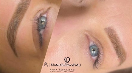 Εικόνα Permanent makeup & Tattoo removal By Asma (lipblush) 3