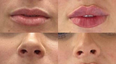 Debbie's aesthetics & training academy slika 3