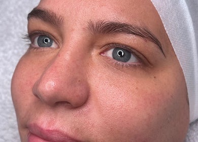 Close-up of rejuvenated skin treatment at Brighton Marina Skin Co, Brighton And Hove, England, GB.