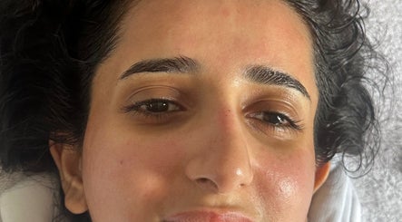 Close-up of a woman's glowing skin post-treatment at Brighton Marina Skin Co, Brighton And Hove, England, GB.