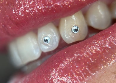 Decoración dental brillante en sstonegemss, Barcelona, Catalunya, ES. Destaca tu sonrisa con estilo único.