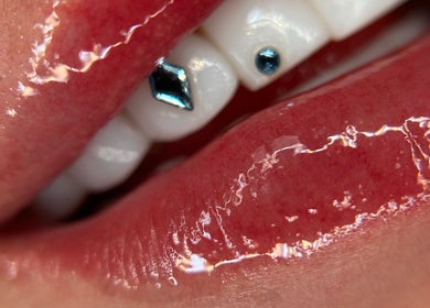 Dientes con incrustaciones brillantes en sstonegemss, Barcelona, Catalunya, ES. Glamour y estética dental.