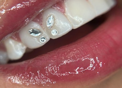 Decoración dental con gemas brillantes en sstonegemss, Barcelona, Catalunya, ES.