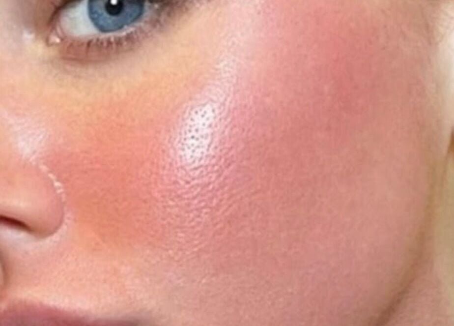 Close-up of radiant skin at Rhiannon Kennedy Wellness, Stevenage, England, GB.