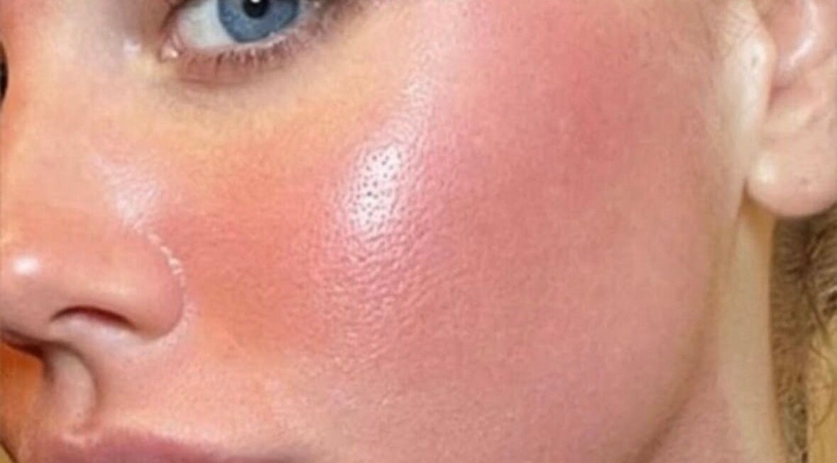 Close-up of radiant skin at Rhiannon Kennedy Wellness, Stevenage, England, GB.