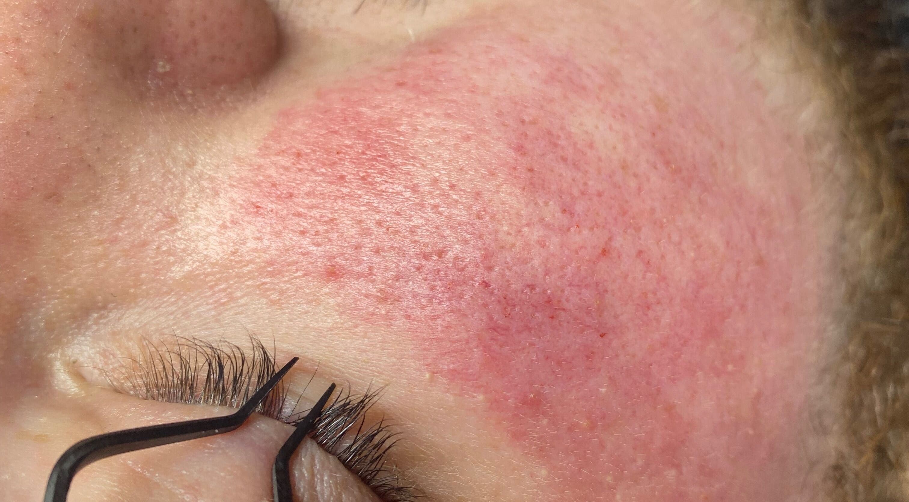 Close-up of radiant skin after treatment at Diversity Skin & Beauty Studio, Pontypool, Wales, GB.