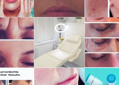 Infusion Aesthetics UT Clinic in Burgess Hill showcases serene treatment room and skincare results.