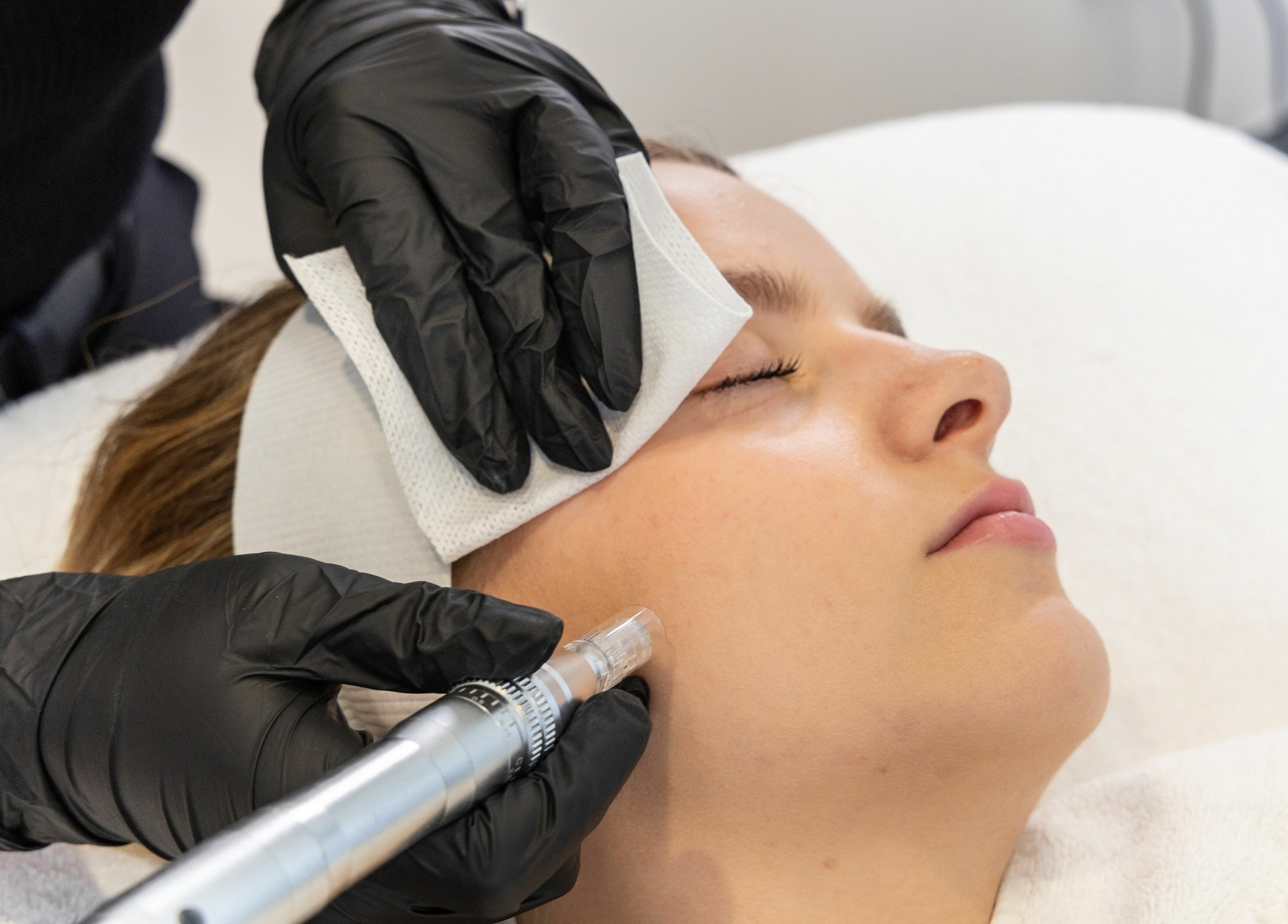 Facial treatment at Sophie Austin Skin, Karrinyup, WA, AU, highlighting precision skincare service.