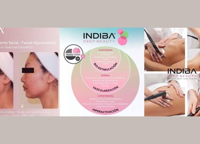 Rejuvenecimiento facial en Estetica Avanzada Y Bienestar Ania Iglesias, Madrid, Comunidad De Madrid, ES.