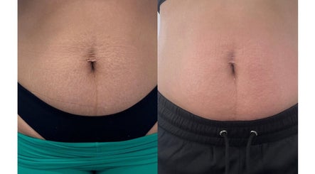 Thebdyclinic image 2