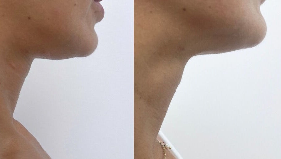 Thebdyclinic image 1