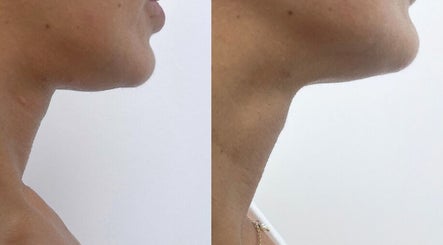 Thebdyclinic