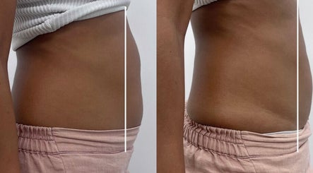 Thebdyclinic image 2
