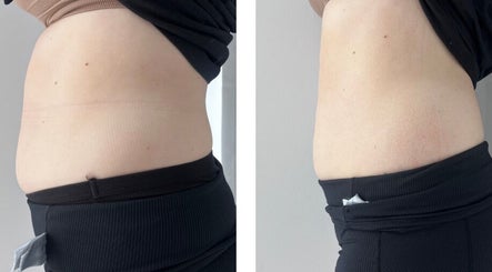 Thebdyclinic image 3