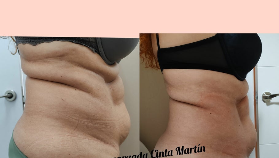 Estética Cinta Martín изображение 1