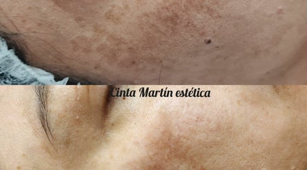 Estética Cinta Martín изображение 2