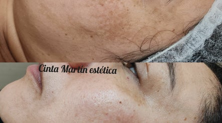 Estética Cinta Martín imagem 3