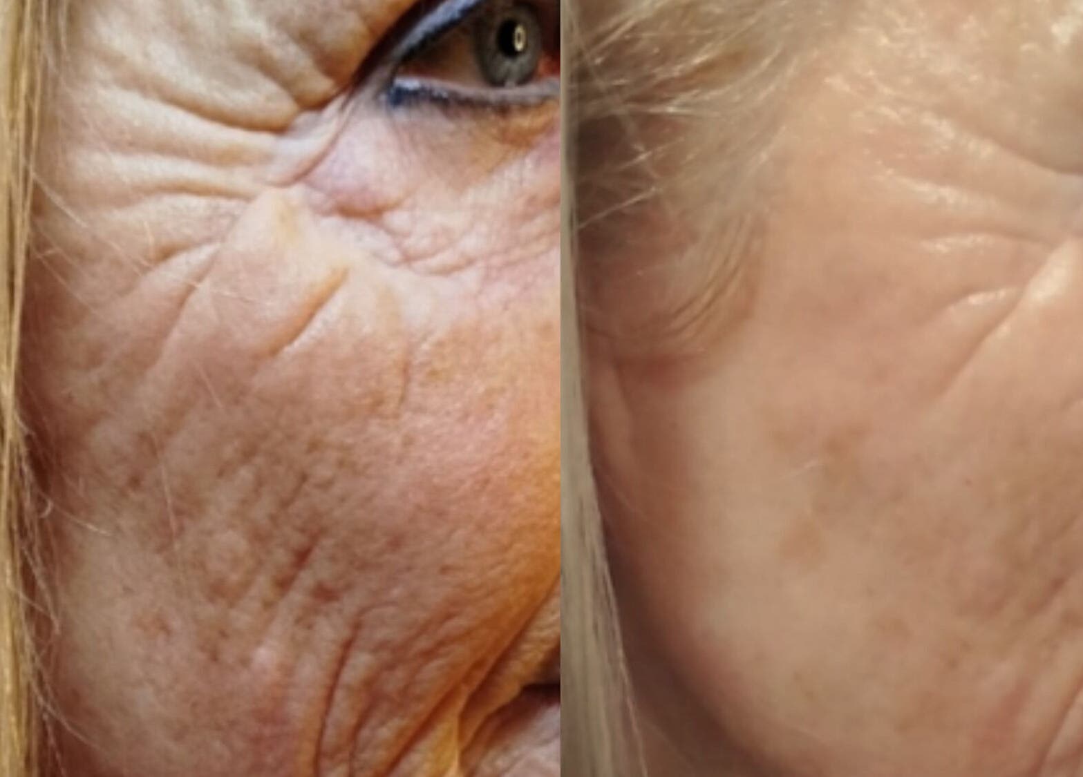 Avant-après soins anti-âge à LMC le moment cocooning à domicile, Vair-sur-loire, Pays De La Loire, FR.