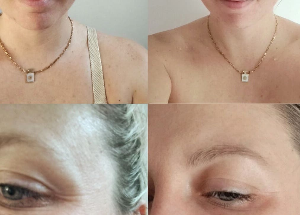 Avant-après beauté à LMC le moment cocooning à domicile, Vair-sur-loire, Pays De La Loire, FR.