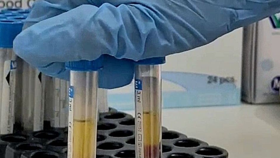Close-up of lab glove holding test tubes at Stella Medical Aesthetics, Dublin, County Dublin, IE.