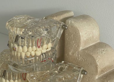 DOLLY DENTAL - TEETH WHITENING & TOOTH GEMS model at Maroochy River, Queensland, AU showcasing premium tooth gems.