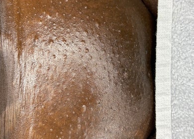 Smooth, radiant skin at BeBeautifiedByEm in Oistins, Christ Church, BB, highlighting a serene treatment experience.