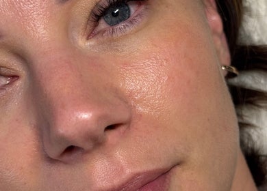 Close-up of a glowing complexion post-facial at Beauty Lounge, London, Ontario, CA.