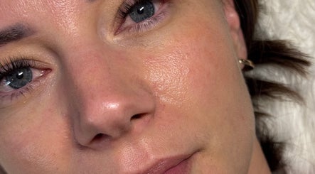 Close-up of a glowing complexion post-facial at Beauty Lounge, London, Ontario, CA.