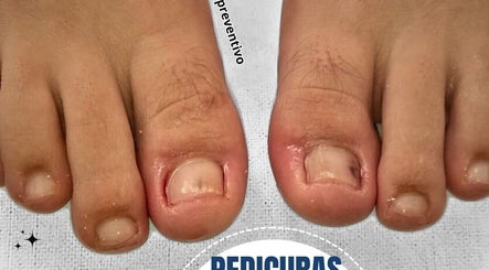 PIESALUD SPA PREVENTIVO, bilde 2
