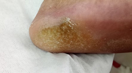 PIESALUD SPA PREVENTIVO, bilde 3