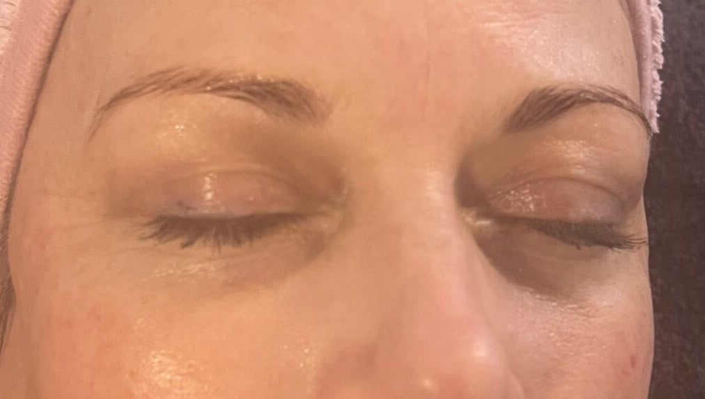 Close-up of a relaxed client post-treatment at Fresh Faces, Port Erin, Port Erin, IM. Skin appears radiant and serene.