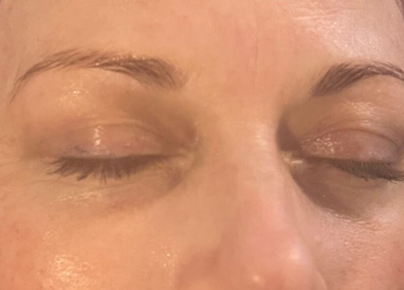 Close-up of a relaxed client post-treatment at Fresh Faces, Port Erin, Port Erin, IM. Skin appears radiant and serene.